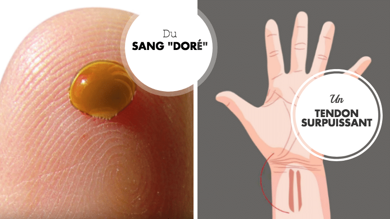 particularites physiques insolites tendon6