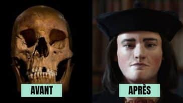 reconstitution faciale avant apres histoire