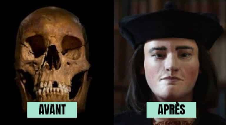 reconstitution faciale avant apres histoire